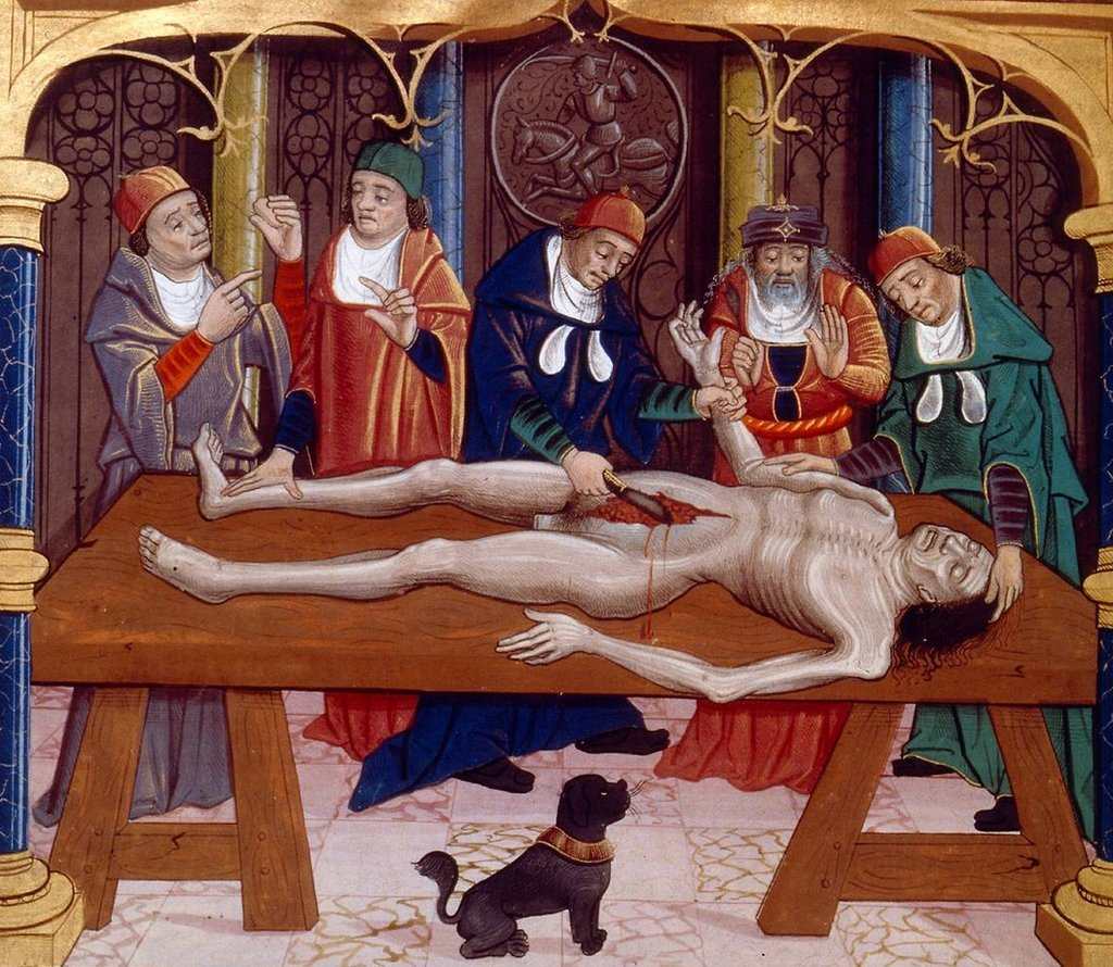 Por que el canibalismo fue considerado una buena medicina en el Renacimiento – Prensa Libre