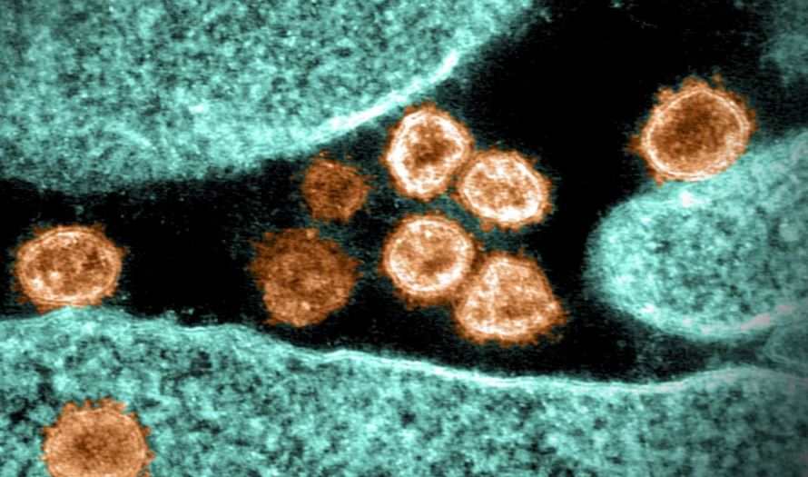 ¿Cuál es la variante “mu” del coronavirus que ya ha sido identificada en países como Guatemala – Prensa Libre
